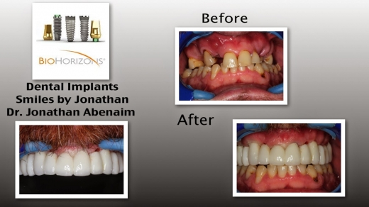 Photo by <br />
<b>Notice</b>:  Undefined index: user in <b>/home/www/activeuser/data/www/vaplace.com/core/views/default/photos.php</b> on line <b>128</b><br />
. Picture for Jonathan Dental Spa Dental Implant Center Jonathan Abenaim DMD in Hawthorne City, New Jersey, United States - Point of interest, Establishment, Health, Dentist