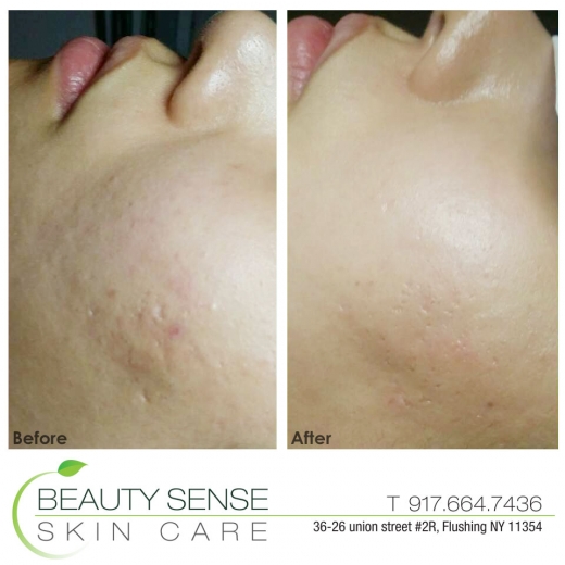 Beauty Sense Skin Care in Queens City, New York, United States - #3 Photo of Point of interest, Establishment, Health