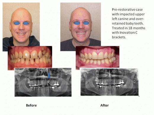 Perfect Smiles Orthodontics in New York City, New York, United States - #3 Photo of Point of interest, Establishment, Health, Dentist