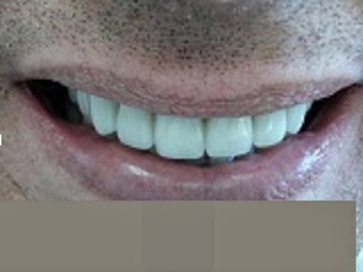 Dr. David A. Klebanow in Williston Park City, New York, United States - #1 Photo of Point of interest, Establishment, Health, Dentist
