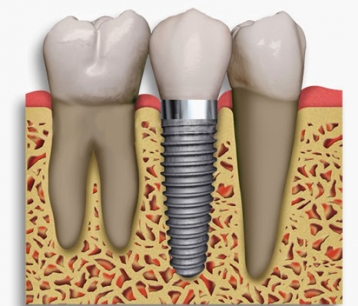 Georgetown Dental Spa in Brooklyn City, New York, United States - #4 Photo of Point of interest, Establishment, Health, Dentist