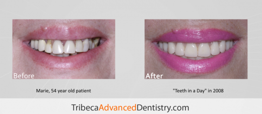 Photo by <br />
<b>Notice</b>:  Undefined index: user in <b>/home/www/activeuser/data/www/vaplace.com/core/views/default/photos.php</b> on line <b>128</b><br />
. Picture for Tribeca Advanced Dentistry in New York City, New York, United States - Point of interest, Establishment, Health, Dentist