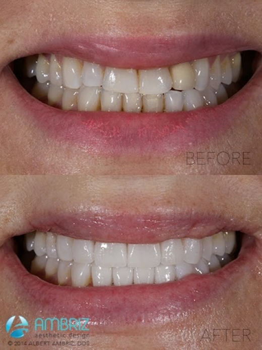 Photo by <br />
<b>Notice</b>:  Undefined index: user in <b>/home/www/activeuser/data/www/vaplace.com/core/views/default/photos.php</b> on line <b>128</b><br />
. Picture for Cosmetic Dentist, Dr. Alberto Ambriz, DDS in New York City, New York, United States - Point of interest, Establishment, Health, Dentist