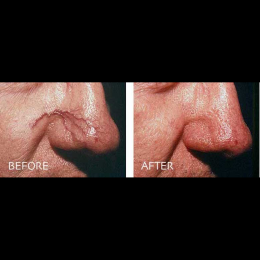 Juvederm in New York City, New York, United States - #3 Photo of Point of interest, Establishment, Health, Doctor