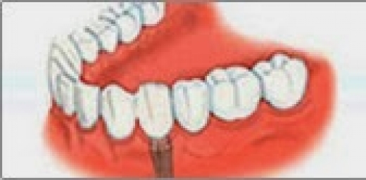 Photo by <br />
<b>Notice</b>:  Undefined index: user in <b>/home/www/activeuser/data/www/vaplace.com/core/views/default/photos.php</b> on line <b>128</b><br />
. Picture for Janas Dental in Bronx City, New York, United States - Point of interest, Establishment, Health, Doctor, Dentist