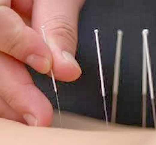 Restore Qi Acupuncture, LLC in Highlands City, New Jersey, United States - #4 Photo of Point of interest, Establishment, Health, Doctor