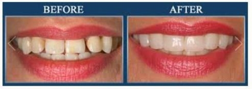 Fidelity Dental Care - Dr. M. F. Karam DDS in Bronx City, New York, United States - #4 Photo of Point of interest, Establishment, Health, Dentist