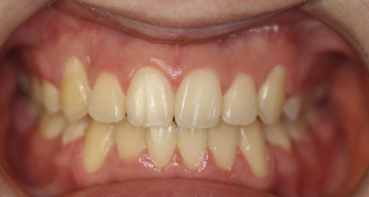 Orthodontist Middletown, NJ-Matthew Choi DMD in Middletown City, New Jersey, United States - #4 Photo of Point of interest, Establishment, Health, Dentist