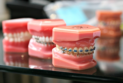 Braces and Smiles - Invisalign Orthodontist Queens NY in Queens City, New York, United States - #4 Photo of Point of interest, Establishment, Health, Dentist