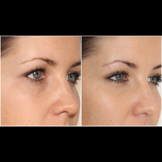 Photo by <br />
<b>Notice</b>:  Undefined index: user in <b>/home/www/activeuser/data/www/vaplace.com/core/views/default/photos.php</b> on line <b>128</b><br />
. Picture for Eye Fillers NYC in New York City, New York, United States - Point of interest, Establishment, Health, Doctor