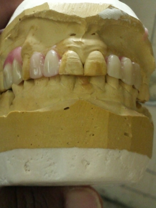 Photo by Classic Dental Laboratory for Classic Dental Laboratory