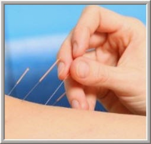 Acupuncture Wellness Roslyn P.C. in Roslyn City, New York, United States - #3 Photo of Point of interest, Establishment, Health, Doctor