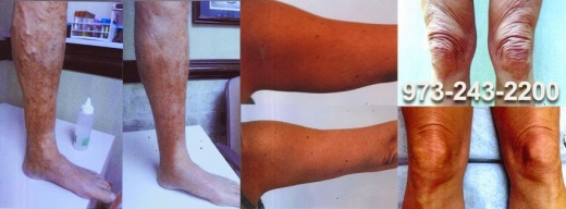 Photo by Dr. Fretta's Total Vein Care for Dr. Fretta's Total Vein Care