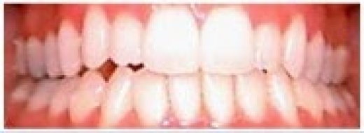 Rizzo Gerald V DDS in Carlstadt City, New Jersey, United States - #4 Photo of Point of interest, Establishment, Health, Dentist